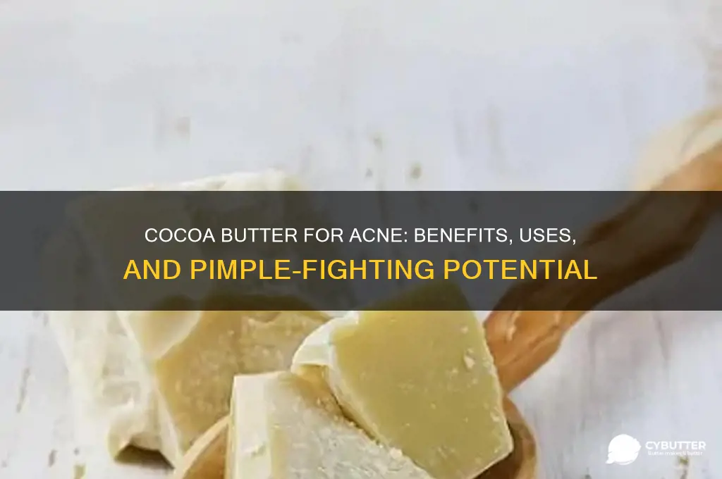 is cocoa butter good for pimples