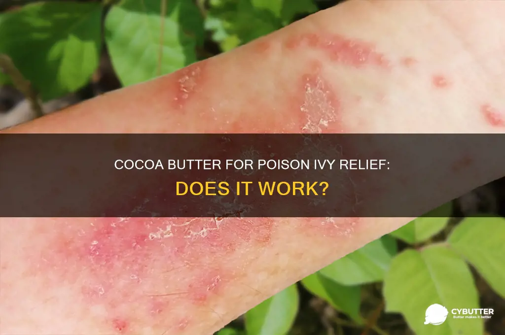 is cocoa butter good for poison ivy