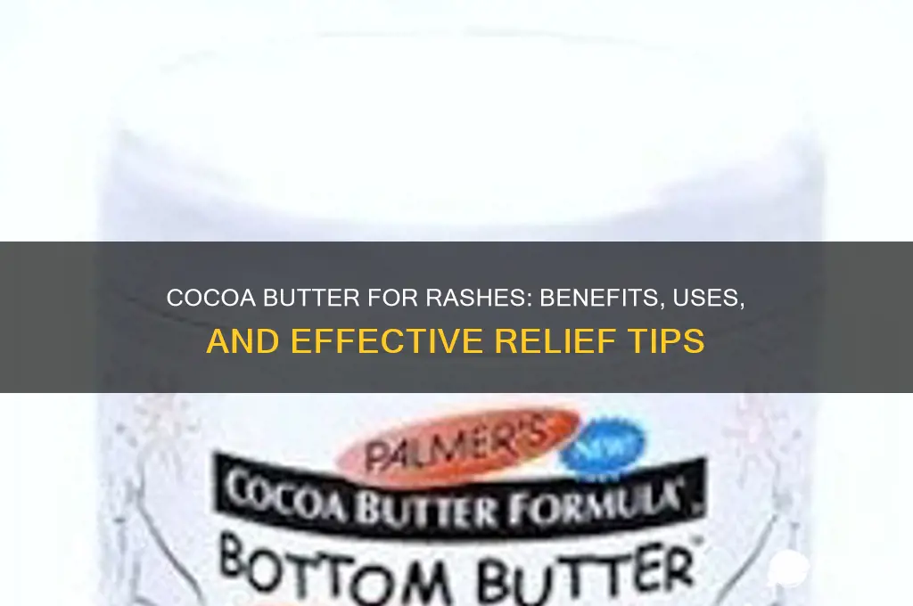 is cocoa butter good for rashes