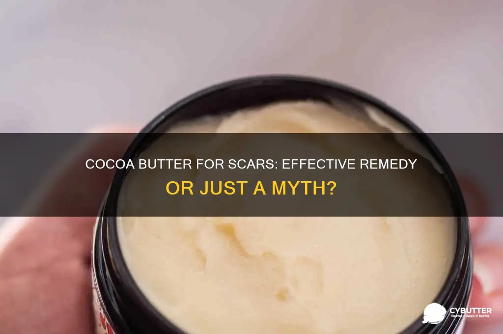 is cocoa butter good for scar removal