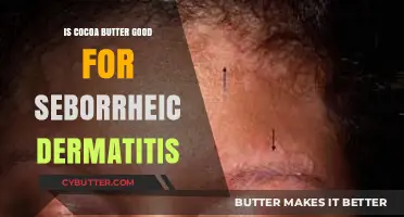 Cocoa Butter for Seborrheic Dermatitis: Benefits and Effectiveness Explained