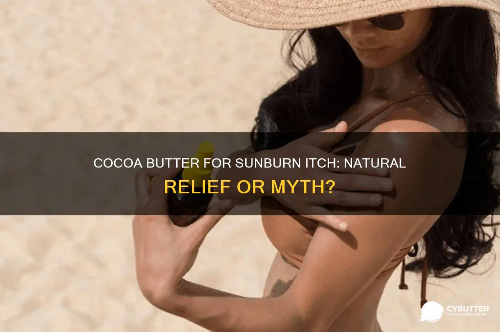 is cocoa butter good for sunburn itch