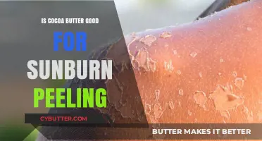 Cocoa Butter for Sunburn Peeling: Healing Benefits and How to Use