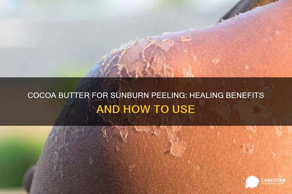 is cocoa butter good for sunburn peeling