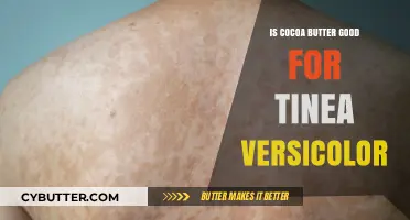 Cocoa Butter for Tinea Versicolor: Benefits, Uses, and Effectiveness