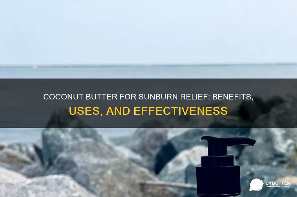 is coconut butter good for sunburn