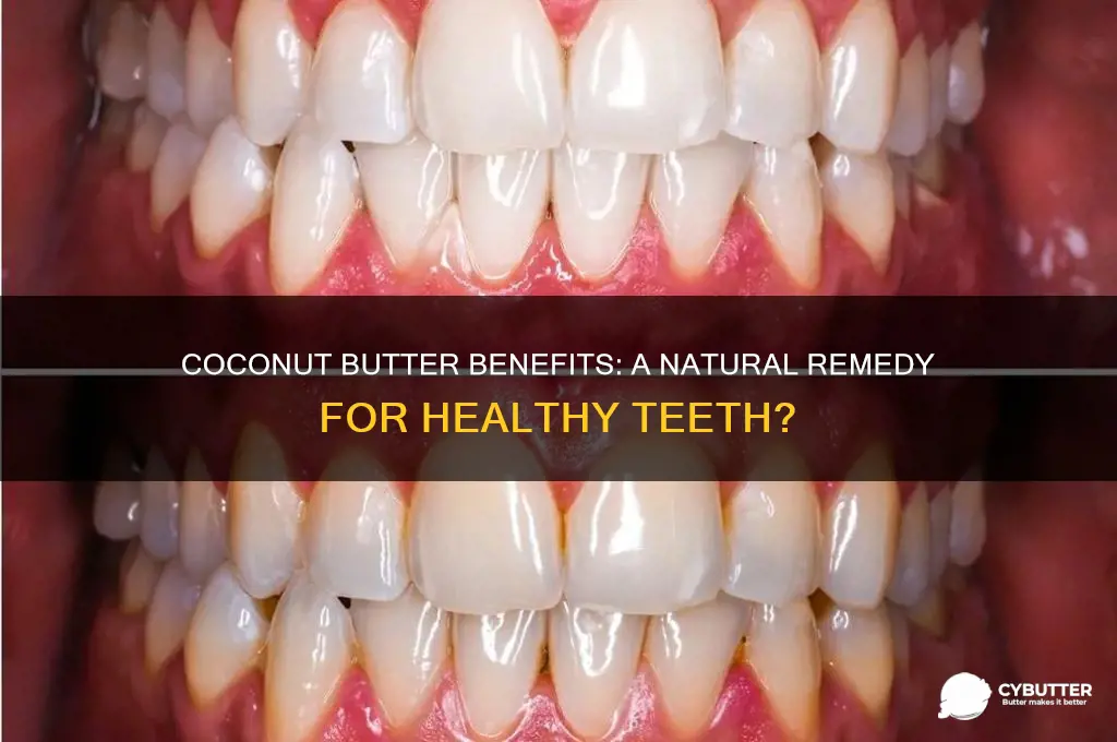 is coconut butter good for your teeth