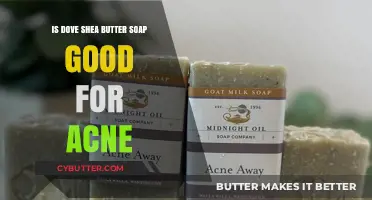 Dove Shea Butter Soap: Effective Acne Treatment or Just Hype?