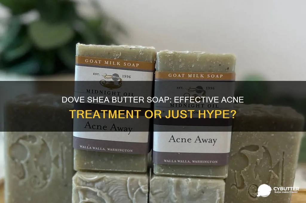 is dove shea butter soap good for acne