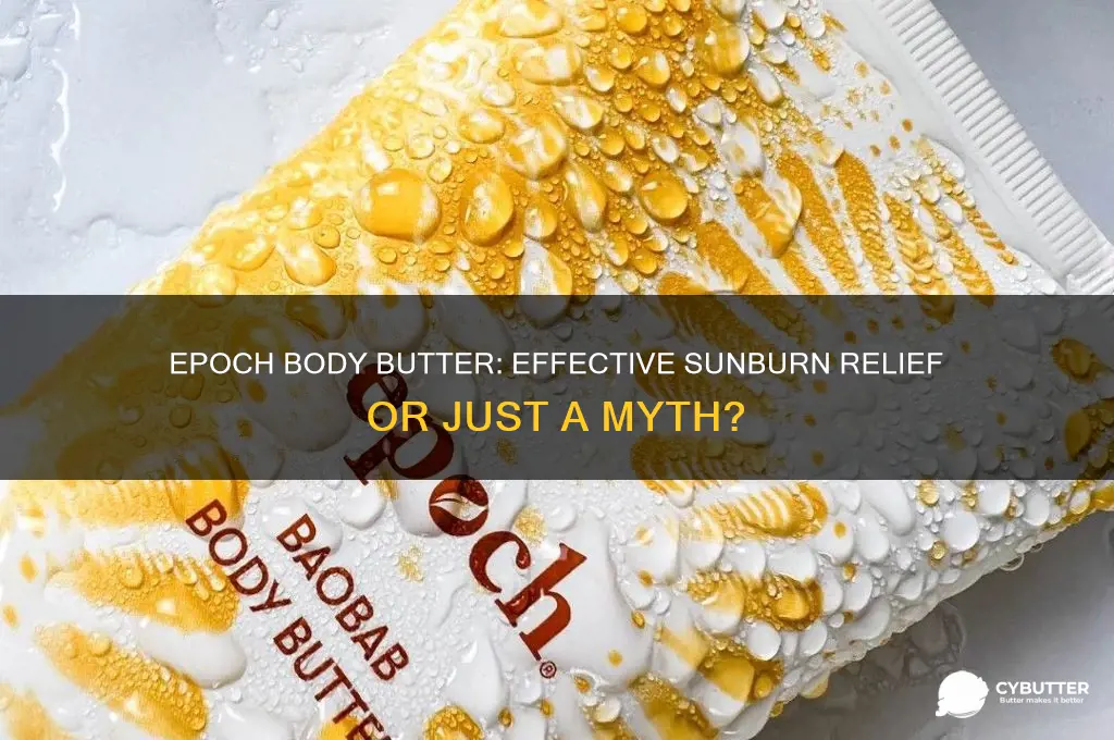 is epoch body butter good for sunburn