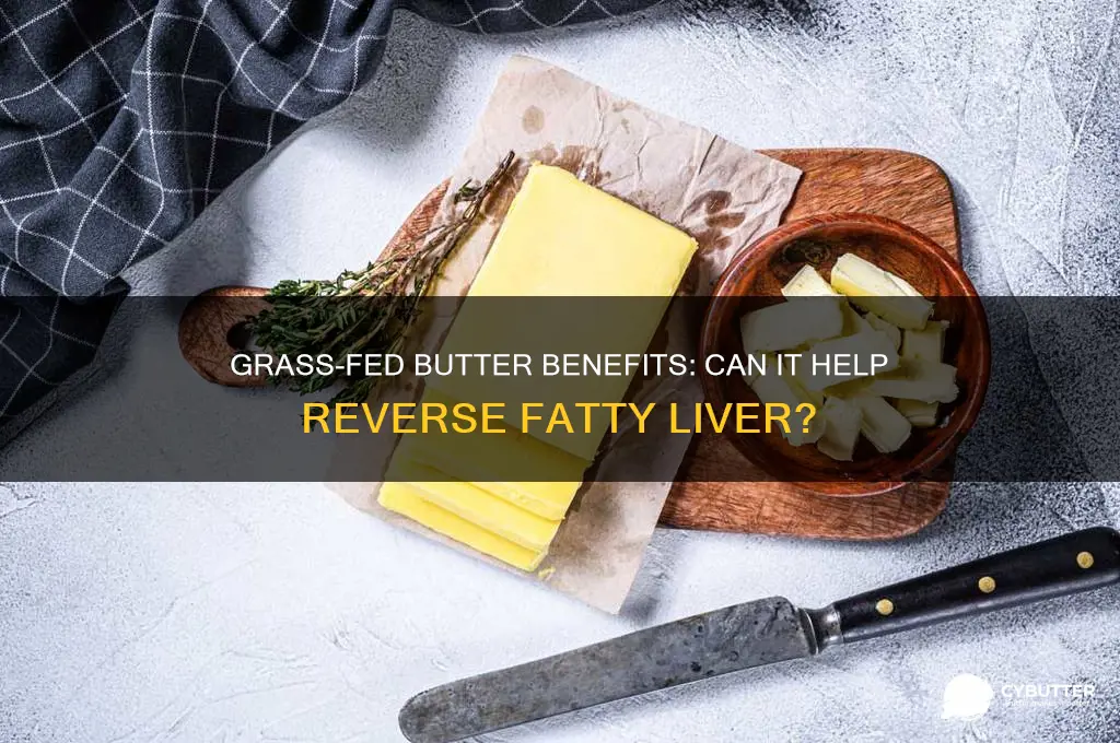 is grass fed butter good for fatty liver
