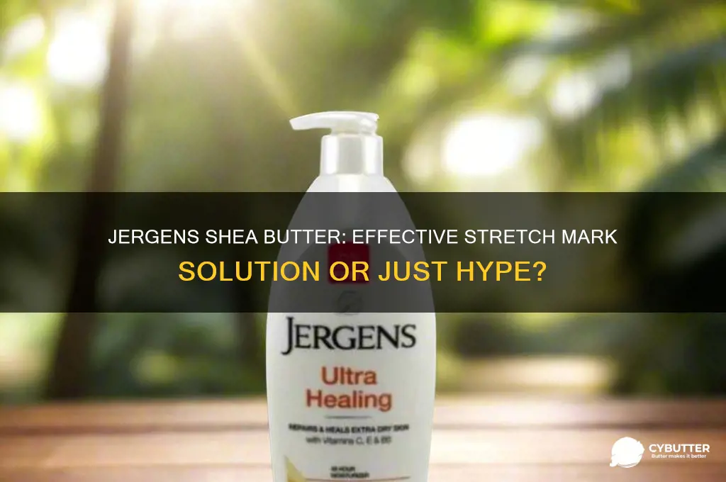 is jergens shea butter good for stretch marks