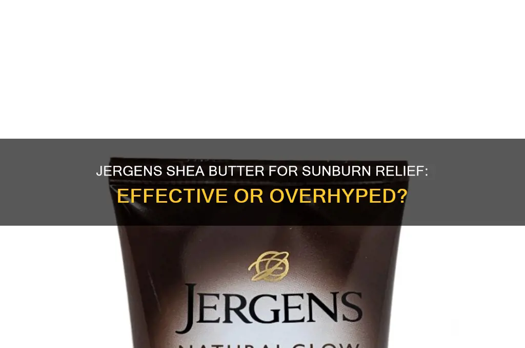 is jergens shea butter good for sunburn