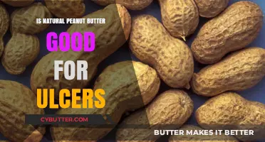 Natural Peanut Butter: A Healing Choice for Ulcers or Not?
