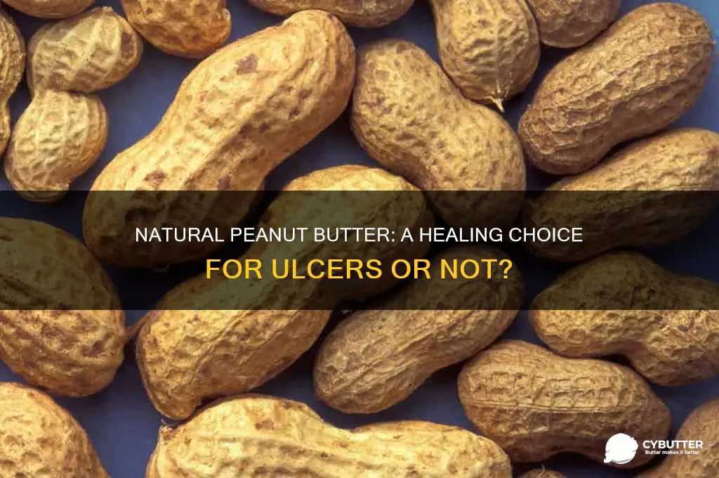 is natural peanut butter good for ulcers