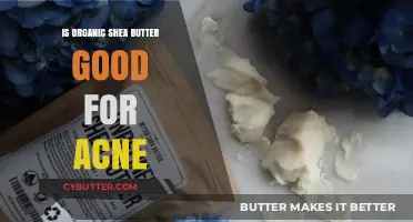Organic Shea Butter for Acne: Benefits, Uses, and Effectiveness