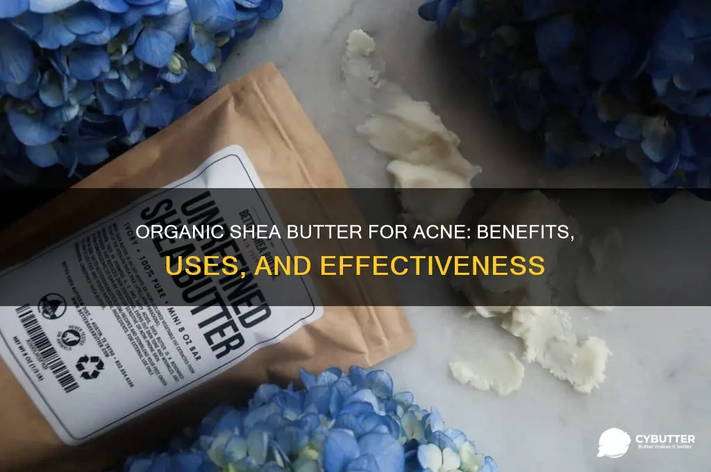 is organic shea butter good for acne