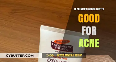 Palmer's Cocoa Butter for Acne: Benefits, Uses, and Effectiveness