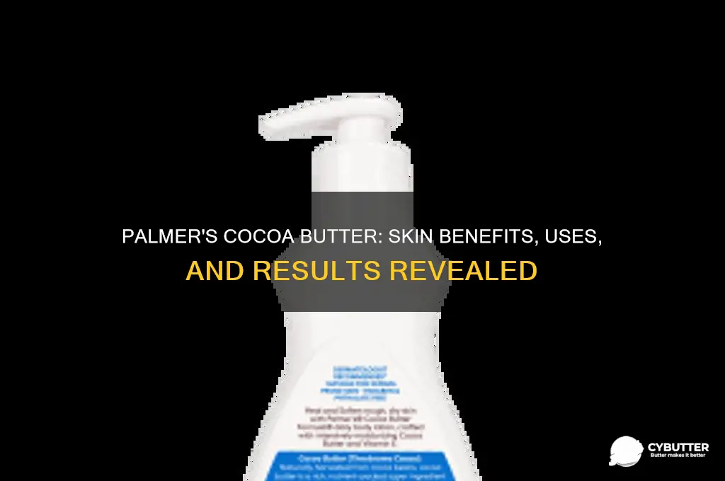 is palmer