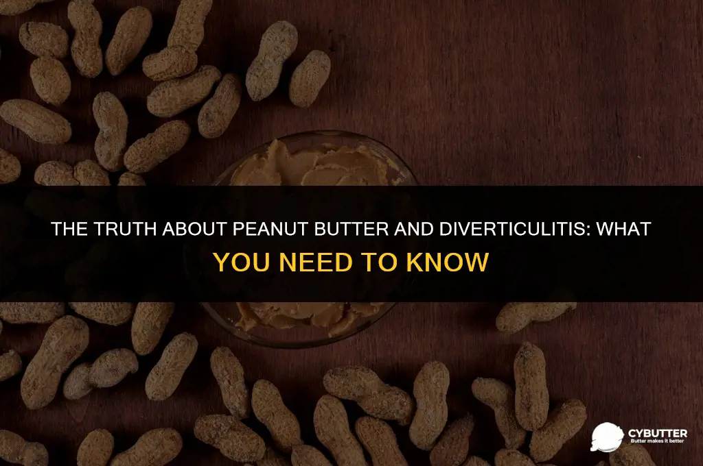 is peanut butter bad for diverticulitis
