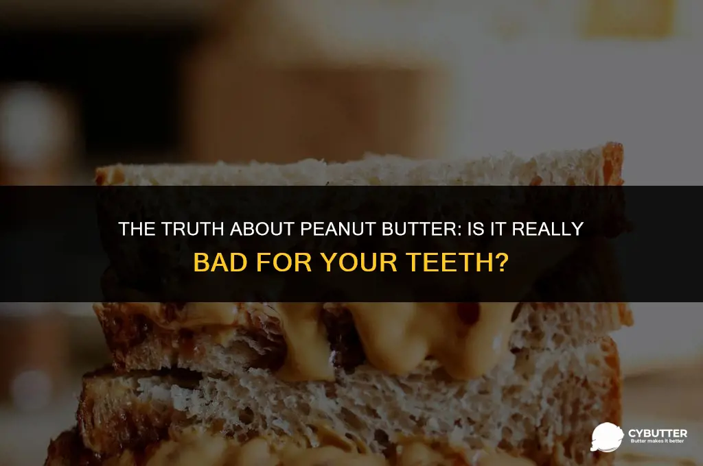 is peanut butter bad for teeth