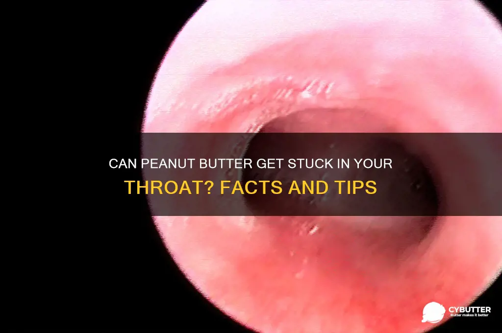 is peanut butter easy to get stuck in your throat
