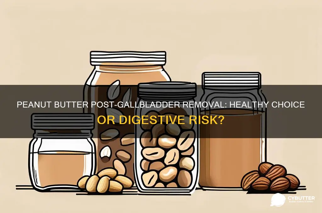 is peanut butter good after gallbladder removal