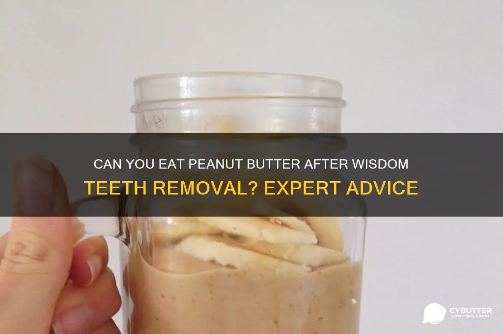 is peanut butter good after wisdom teeth removal
