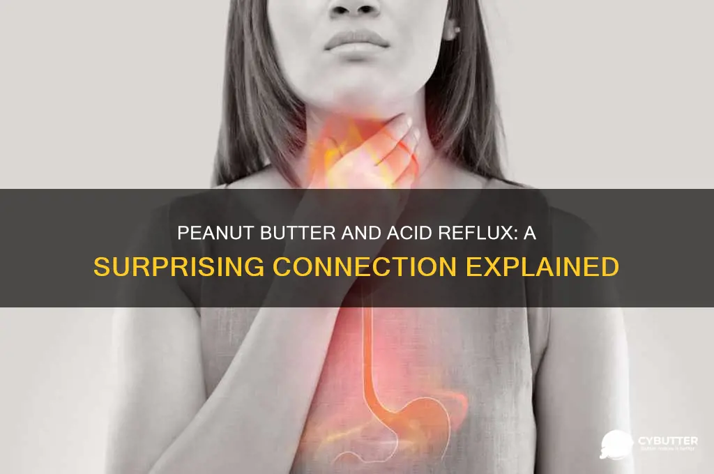 is peanut butter good for acid reflux