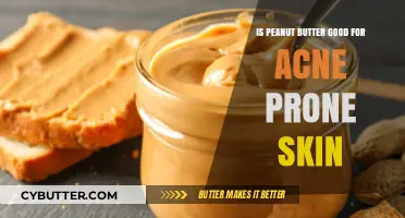 Peanut Butter and Acne: Skin Benefits or Breakout Trigger?