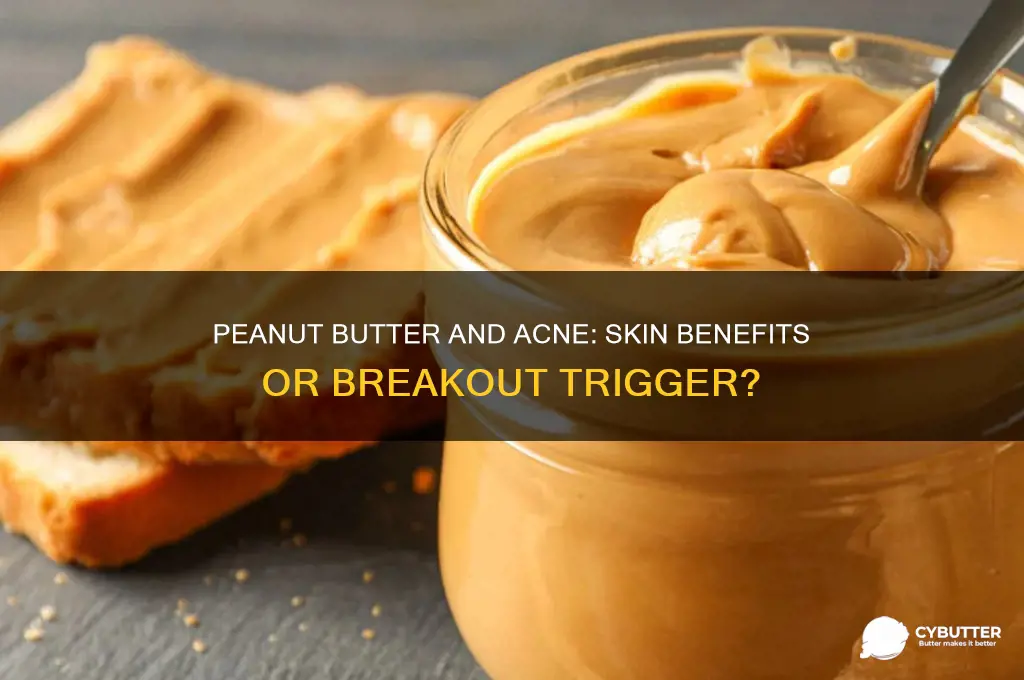 is peanut butter good for acne prone skin
