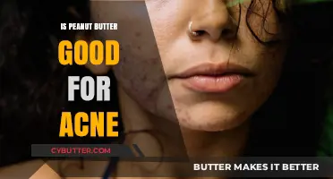Peanut Butter and Acne: Benefits, Myths, and Skin-Friendly Tips