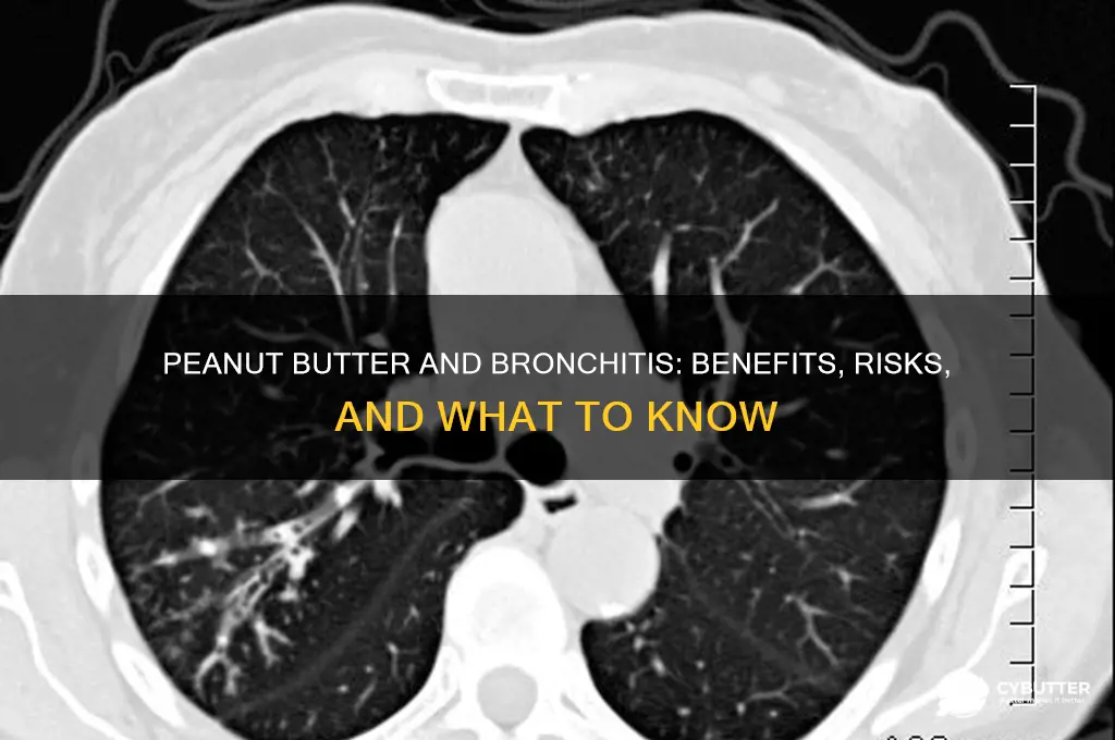 is peanut butter good for bronchitis