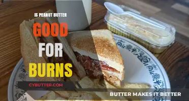 Peanut Butter for Burns: Effective Remedy or Harmful Myth?