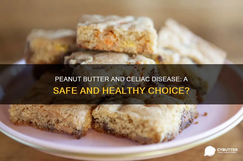 is peanut butter good for celiac disease