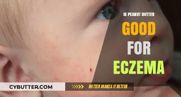 Peanut Butter and Eczema: Benefits, Risks, and Skin Health Tips