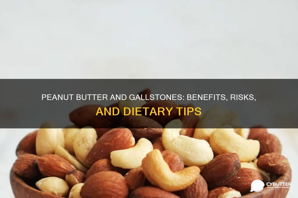 is peanut butter good for gallstones