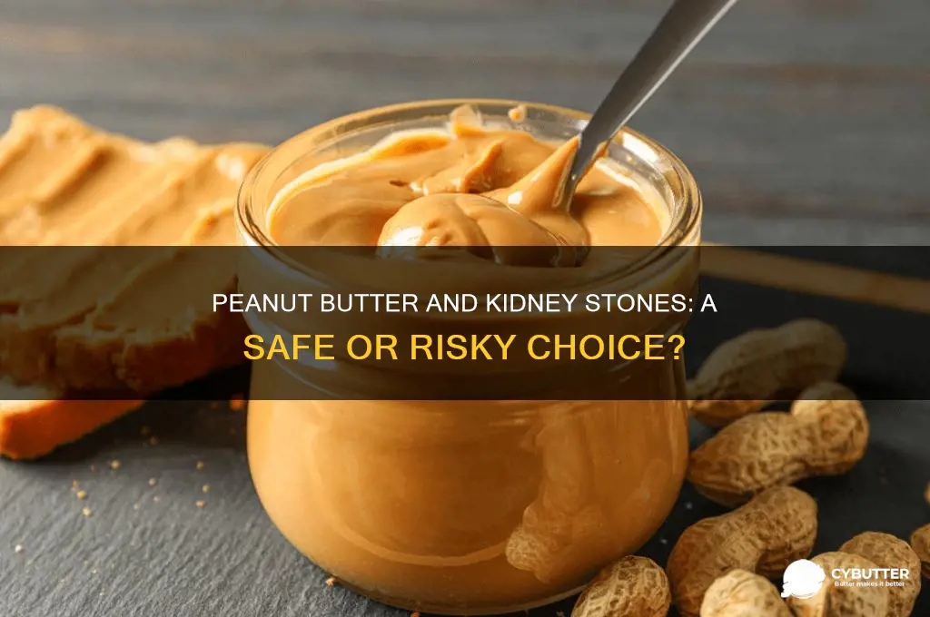 is peanut butter good for kidney stone patients