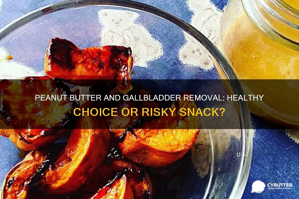 is peanut butter good for no gallbladder