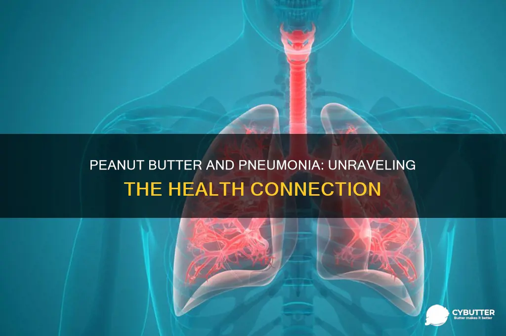 is peanut butter good for pneumonia