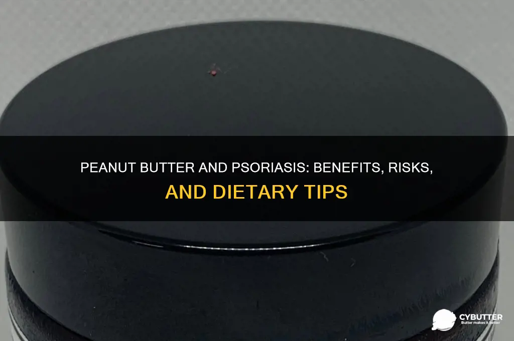 is peanut butter good for psoriasis