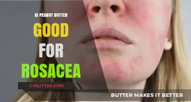 Peanut Butter and Rosacea: Uncovering the Truth for Clearer Skin