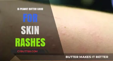 Peanut Butter for Skin Rashes: Benefits, Risks, and Usage Tips