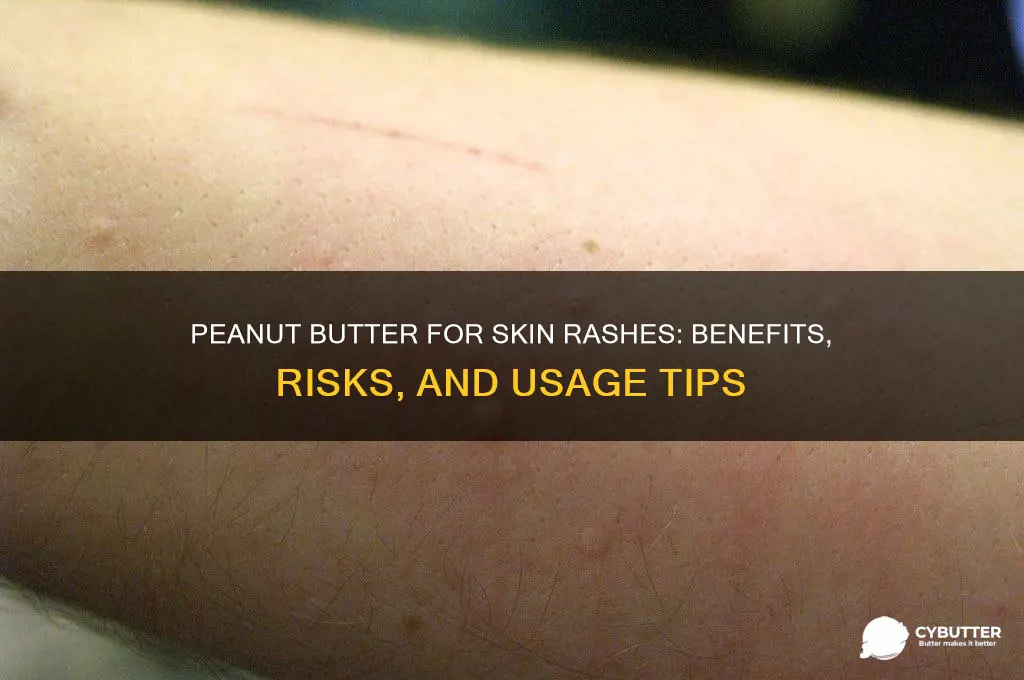 is peanut butter good for skin rashes
