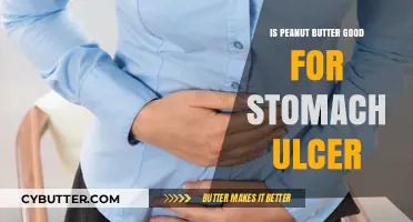 Peanut Butter and Stomach Ulcers: Healing or Harmful Choice?