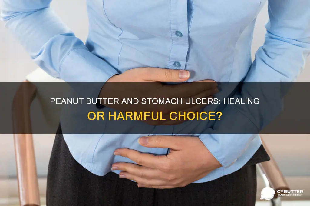 is peanut butter good for stomach ulcer
