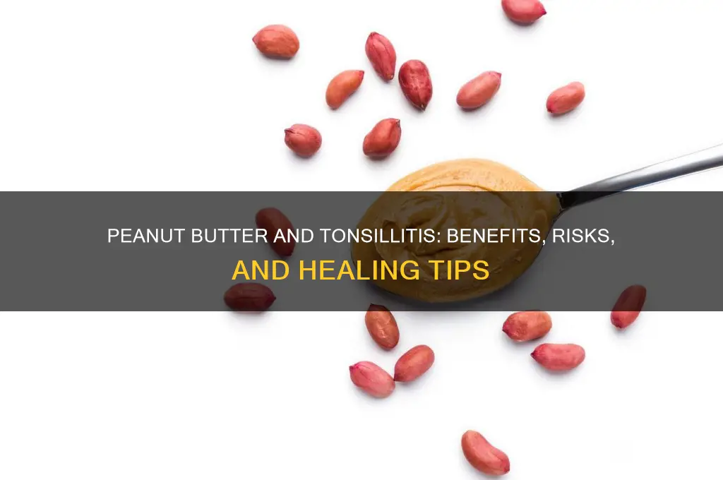 is peanut butter good for tonsillitis