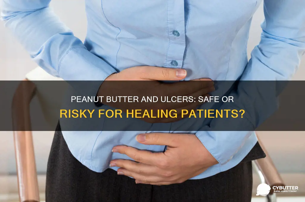is peanut butter good for ulcer patient