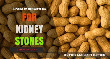 Peanut Butter and Kidney Stones: Friend or Foe for Kidney Health?