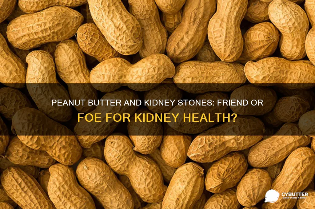 is peanut butter good or bad for kidney stones